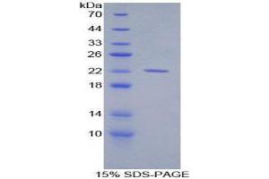 SDS-PAGE (SDS) image for Aconitase 1 (ACO1) (AA 527-719) protein (His tag) (ABIN2120441)
