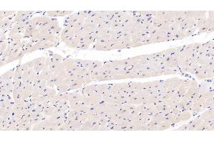 Detection of SOD3 in Human Cardiac Muscle Tissue using Monoclonal Antibody to Superoxide Dismutase 3, Extracellular (SOD3) (SOD3 antibody  (AA 19-240))