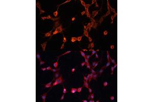 Immunofluorescence analysis of NIH/3T3 cells using P Glycoprotein antibody (ABIN6129943, ABIN6136341, ABIN6136344 and ABIN6216612) at dilution of 1:100.
