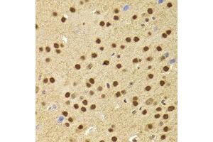 Immunohistochemistry (Paraffin-embedded Sections) (IHC (p)) image for anti-Acidic (Leucine-Rich) Nuclear phosphoprotein 32 Family, Member A (ANP32A) (AA 1-170) antibody (ABIN6136909)