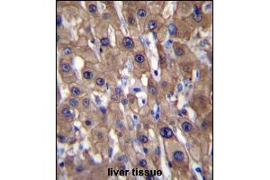 T1A Antibody (N-term) (ABIN656632 and ABIN2845877) immunohistochemistry analysis in forlin fixed and paraffin embedded hun liver tissue followed by peroxidase conjugation of the secondary antibody and DAB staining.