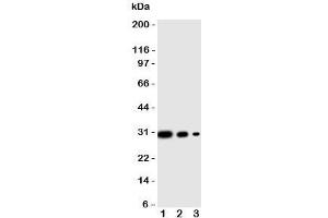 Western blot testing of CRTC1 antibody and human recombinant protein, 29KD with tag;  Lane 1: 10ng;  2: 5ng;  3: 2. (CRTC1 antibody  (C-Term))