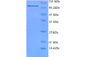 SDS-PAGE (SDS) image for T-Complex 1 (TCP1) (AA 1-680), (full length) protein (His tag) (ABIN4975890)