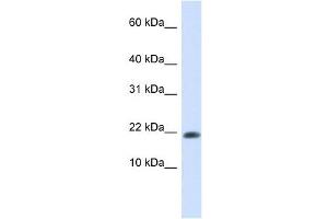 GABARAPL2 antibody used at 1 ug/ml to detect target protein.