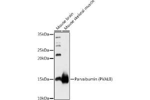 Western blot analysis of extracts of various cell lines, using Parvalbumin (PVALB) antibody (ABIN6128526, ABIN6146506, ABIN6146507 and ABIN6217573) at 1:1000 dilution. (PVALB antibody  (AA 1-110))