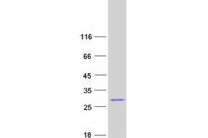 Validation with Western Blot (ZSCAN2 Protein (Transcript Variant 3) (Myc-DYKDDDDK Tag))