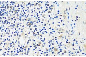 Immunohistochemistry of paraffin-embedded Human appendix using ASCL4 Polyclonal Antibody at dilution of 1:100 (40x lens). (ASCL4 antibody)
