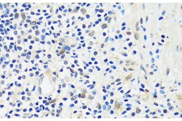 ASCL4 antibody