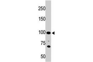 The ACE2 polyclonal antibody  is used in Western blot to detect ACE2 in 293 cell lysate. (ACE2 antibody  (AA 773-805))