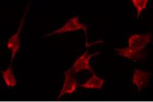 ABIN6274050 staining SK-OV3 by IF/ICC. (EGFR antibody  (pTyr1092))