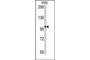 Image no. 1 for anti-Melanoma Antigen Family C, 1 (MAGEC1) (C-Term) antibody (ABIN358656) (MAGEC1 antibody  (C-Term))