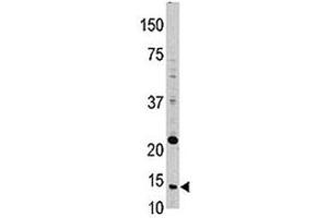 Western blot analysis of Thioredoxin in HL-60 lysate (TXN antibody  (AA 1-30))