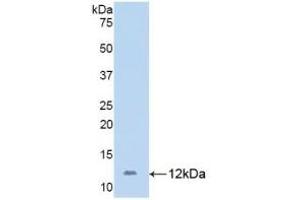 Detection of Recombinant PECAM1, Human using Polyclonal Antibody to Platelet/Endothelial Cell Adhesion Molecule (PECAM1) (CD31 antibody  (AA 199-287))