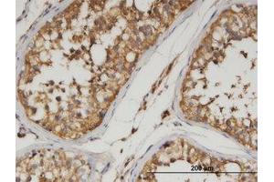 Image no. 1 for anti-Angiopoietin-Like 3 (ANGPTL3) (AA 17-461) antibody (ABIN599551) (ANGPTL3 antibody  (AA 17-461))