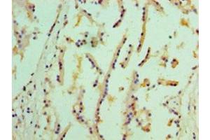 Immunohistochemistry of paraffin-embedded human prostate tissue using ABIN7151949 at dilution of 1:100 (EPHX1 antibody  (AA 1-455))