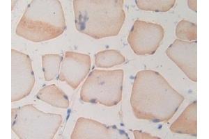 Detection of RNASE3 in Rat Skeletal muscle Tissue using Polyclonal Antibody to Ribonuclease A3 (RNASE3) (RNASE3 antibody  (AA 33-155))