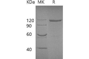 GLB1 Protein (Fc Tag)