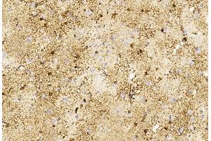 Immunohistochemical analysis of paraffin-embedded Human brain section using Pink1 B. (GFAP antibody)