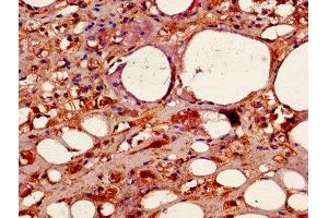 Immunohistochemistry of paraffin-embedded human adrenal gland tissue using ABIN7146893 at dilution of 1:100 (CSNK2B antibody  (AA 1-215))