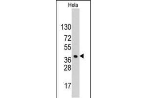 Western blot analysis of anti-HDGF Pab (ABIN390356 and ABIN2840767) in Hela cell line lysates (35 μg/lane).