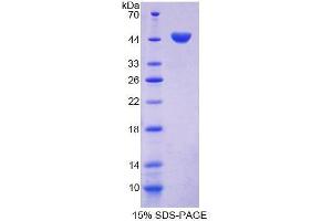 SDS-PAGE (SDS) image for Caveolin 1, Caveolae Protein, 22kDa (CAV1) (AA 2-104) protein (His tag,GST tag) (ABIN2122589)