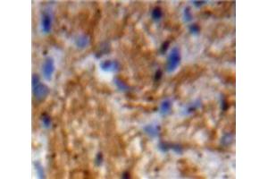 Used in DAB staining on fromalin fixed paraffin-embedded Brain tissue (Neurotrophin 3 antibody  (AA 21-138))
