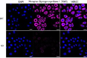 Immunocytochemical staining of HeLa cells using Phospho-Glycogen synthase 1 (S641) antibody (ABIN7798774), 1:1,000), Top panel: wild-type (WT), Bottom panal: Phospho-Glycogen synthase 1 (S641) shRNA knockdown (KD).