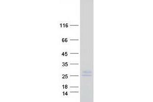 Validation with Western Blot (Tetraspanin 6 Protein (TSPAN6) (Myc-DYKDDDDK Tag))