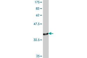 Western Blot detection against Immunogen (37. (MED26 antibody  (AA 501-600))