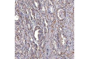 IHC analysis of TRMT2B using anti-TRMT2B antibody (ABIN7599456). (TRMT2B antibody  (AA 1-504))