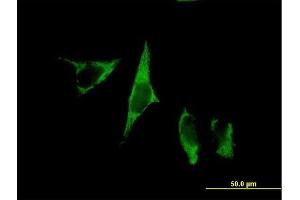 Immunofluorescence of purified MaxPab antibody to MGC48915 on HeLa cell. (C1QTNF9 antibody  (AA 1-333))