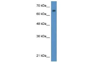WB Suggested Anti-WT1 Antibody Titration:  0. (WT1 antibody  (N-Term))