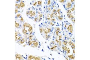 Immunohistochemistry of paraffin-embedded human stomach using FECH antibody (ABIN6130423, ABIN6140573, ABIN6140574 and ABIN6224474) at dilution of 1:100 (40x lens). (FECH antibody  (AA 1-200))