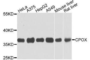 Western blot analysis of extracts of various cells, using CPOX antibody. (CPOX antibody)
