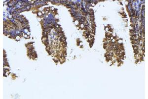 ABIN6273994 at 1/100 staining Mouse colon tissue by IHC-P. (TUBB1 antibody)