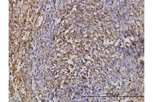Immunoperoxidase of monoclonal antibody to TPMT on formalin-fixed paraffin-embedded human spleen. (TPMT antibody  (AA 1-245))