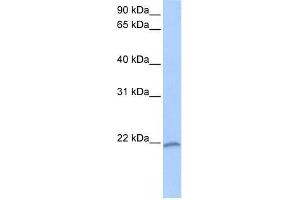 Western Blot showing C8orf77 antibody used at a concentration of 1-2 ug/ml to detect its target protein. (C8orf77 antibody  (C-Term))