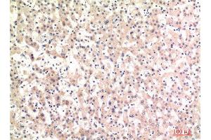 Immunohistochemistry (IHC) analysis of paraffin-embedded Human Liver, antibody was diluted at 1:100. (Complement C4A/C4B (Internal Region) antibody)