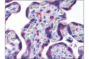 Human Placenta: Formalin-Fixed, Paraffin-Embedded (FFPE) (NLRC3 antibody)