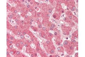 Human Liver: Formalin-Fixed, Paraffin-Embedded (FFPE). (DHODH antibody  (AA 35-84))