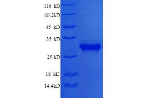 SDS-PAGE (SDS) image for Syntaxin 6 (STX6) (AA 4-231), (partial) protein (His tag) (ABIN5710432)