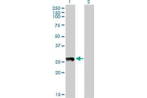 Western Blot analysis of PX19 expression in transfected 293T cell line by PX19 monoclonal antibody (M01), clone 7B4. (PRELID1 antibody  (AA 3-100))