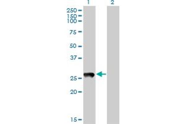 PRELID1 抗体  (AA 3-100)