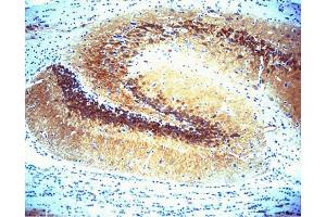 Immunohistochemical staining of CaM Kinase II on rat brain (center panel). (CAMK2A antibody  (AA 448-460))