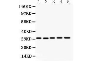 Anti- CD82 Picoband antibody, Western blottingAll lanes: Anti CD82  at 0. (CD82 antibody  (AA 98-267))
