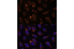 Immunofluorescence analysis of U-2 OS cells using TSFM Polyclonal Antibody (ABIN7271022) at dilution of 1:100 (40x lens). (TSFM antibody  (AA 245-346))
