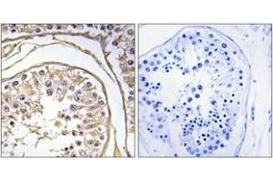 Immunohistochemistry analysis of paraffin-embedded human testis, using BAGE2 Antibody. (BAGE2 antibody  (AA 41-90))