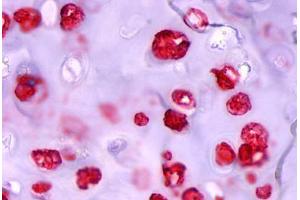 Immunohistochemistry (IHC) image for anti-ADAM Metallopeptidase with Thrombospondin Type 1 Motif, 4 (ADAMTS4) (Disintegrin-like Domain) antibody (ABIN1048291)