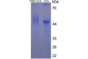 Image no. 3 for Procollagen I N-Terminal Propeptide (PINP) (N-Term) protein (Ovalbumin) (ABIN1880266) (PINP Protein (N-Term) (Ovalbumin))