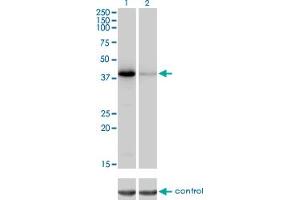 Western blot analysis of NEIL2 over-expressed 293 cell line, cotransfected with NEIL2 Validated Chimera RNAi (Lane 2) or non-transfected control (Lane 1). (NEIL2 antibody  (AA 1-332))
